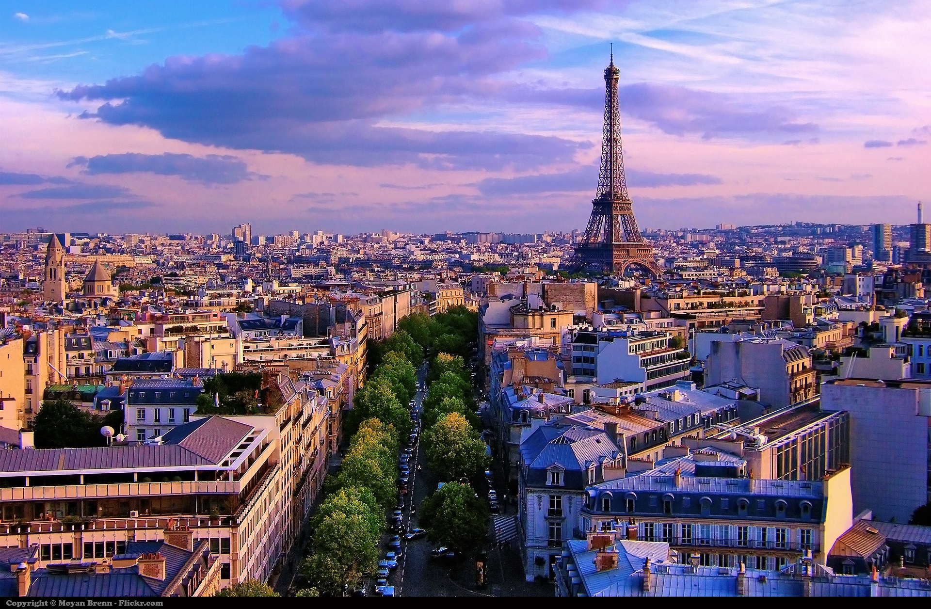 Greffe de cheveux : pourquoi choisir la France face aux options low-cost